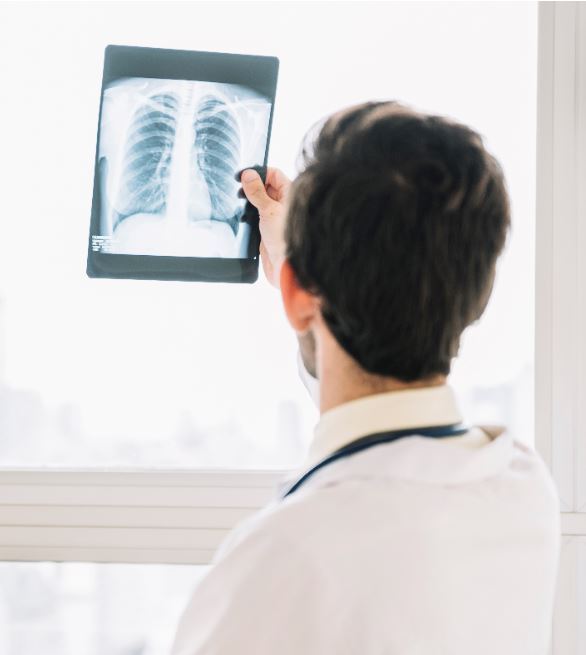 Рентген при астме